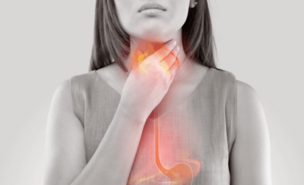 Gastroesophageal reflux disease (GERD): Symptoms, Causes &Treatment