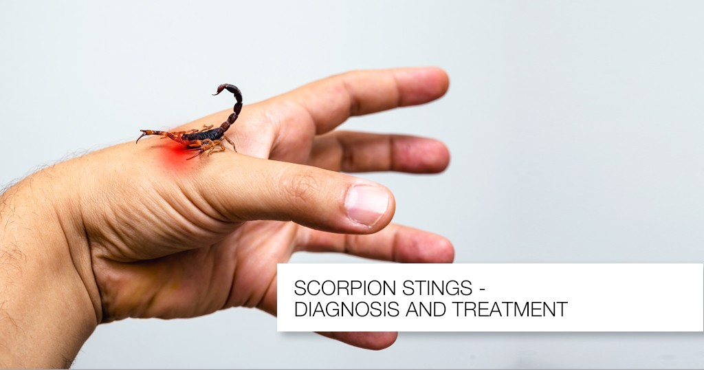 Know about Scorpion Stings